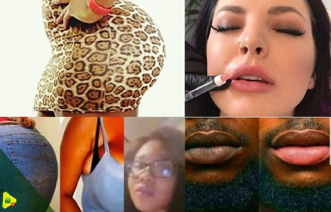 DJ-Arafat-6-mois-de-prison-pour-son-ex-Alexia-Kante-pour-avoir-refait-ses-fesses